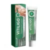 Cvreoz® Vitiligo Treatment Cream
