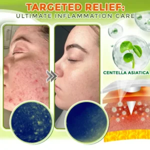 GFOUK® Comprehensive Microneedle Patch