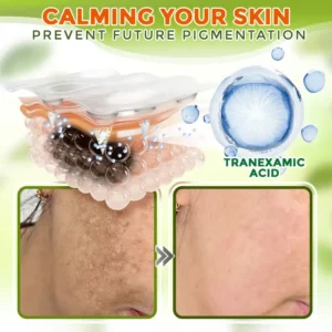 GFOUK® Comprehensive Microneedle Patch