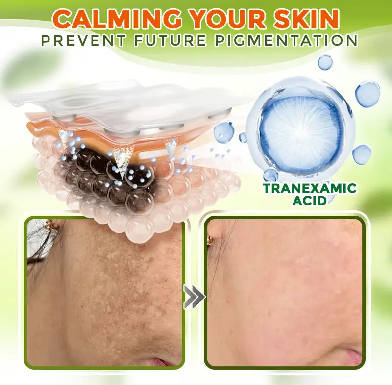 GFOUK® Comprehensive Microneedle Patch