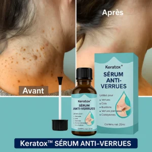 Keratox™ Sérum Anti-Verrues | Éliminez Définitivement les Verrues en 7 Jours Seulement!