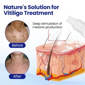 ODEIUN™ Evenora Herbal Spray