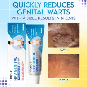 ODEIUN™ HPV Genital Warts Relief Cream