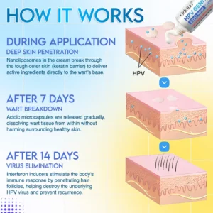 ODEIUN™ HPV Genital Warts Relief Cream