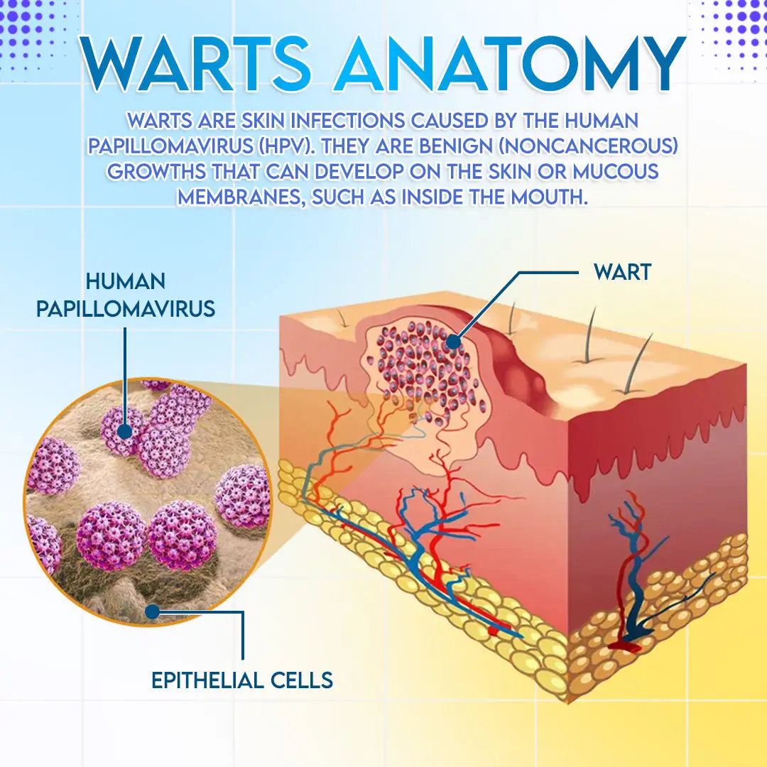 ODEIUN™ HPV Genital Warts Relief Cream