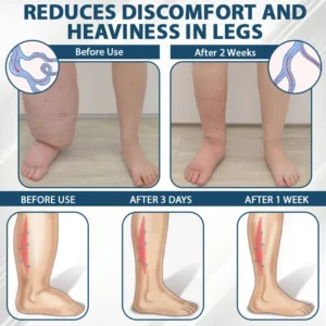 ODEIUN™ VenoPen Easy Drainage TENS Pen