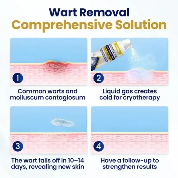 SEAGRIL® ChillErase Bump Renewal Spray