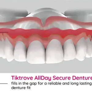 TIKTROVE AllDay Secure Denture Bond