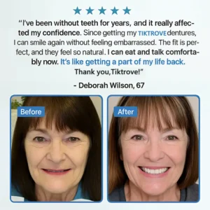 Tiktrove Adsorptive Denture