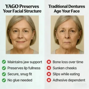 YAGO™ Functional Dentures