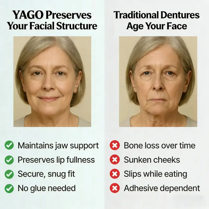 YAGO™ Functional Dentures
