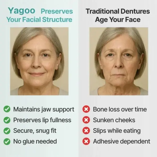 Yagoo™ Medical Full Denture with Strong Suction
