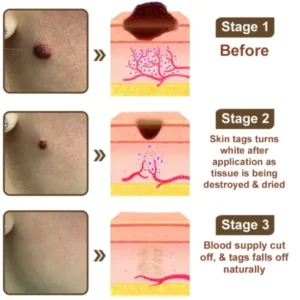 Zvoevo® Rice Bran Essence Cream