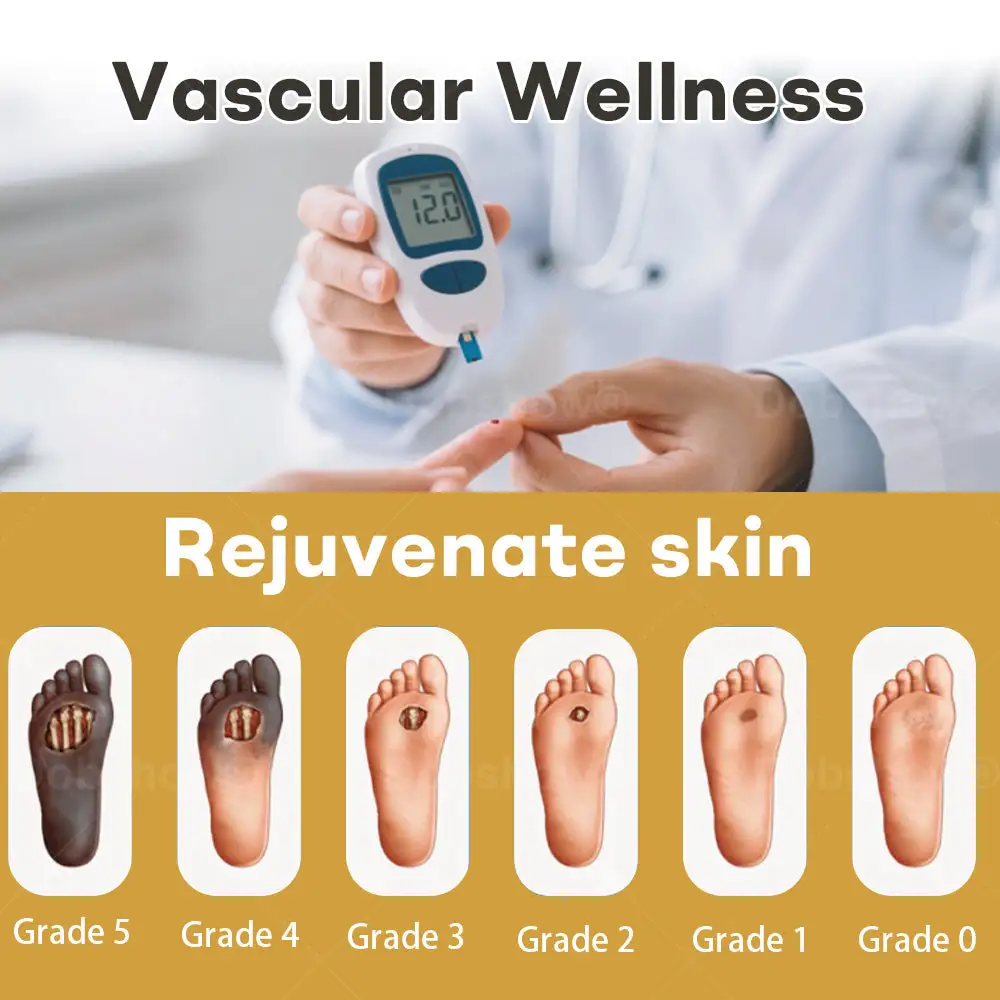 Healrize® GlucoShield Bee Venom Wound Spray