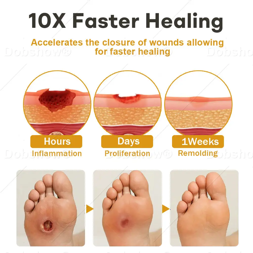 Healrize® GlucoShield Bee Venom Wound Spray