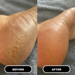 Heeluxe™ Comfort Repair Stick by Shoporia Store