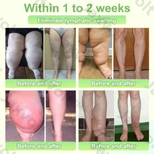 Jaxvolt® Natural Herbal Tourmaline Far Infrared Magnetic Therapy Foot Patches