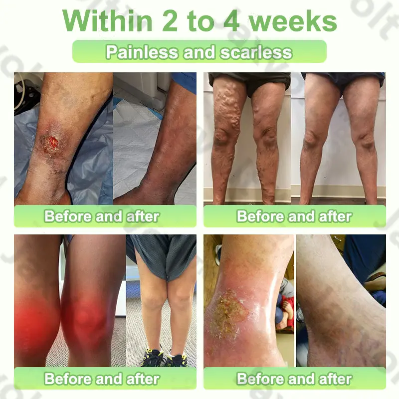 Jaxvolt® Natural Herbal Tourmaline Far Infrared Magnetic Therapy Foot Patches